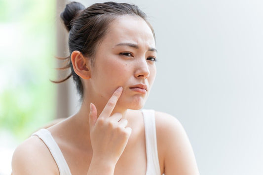 Taking Care of Your Skin During Pimple Breakouts - LivBalance