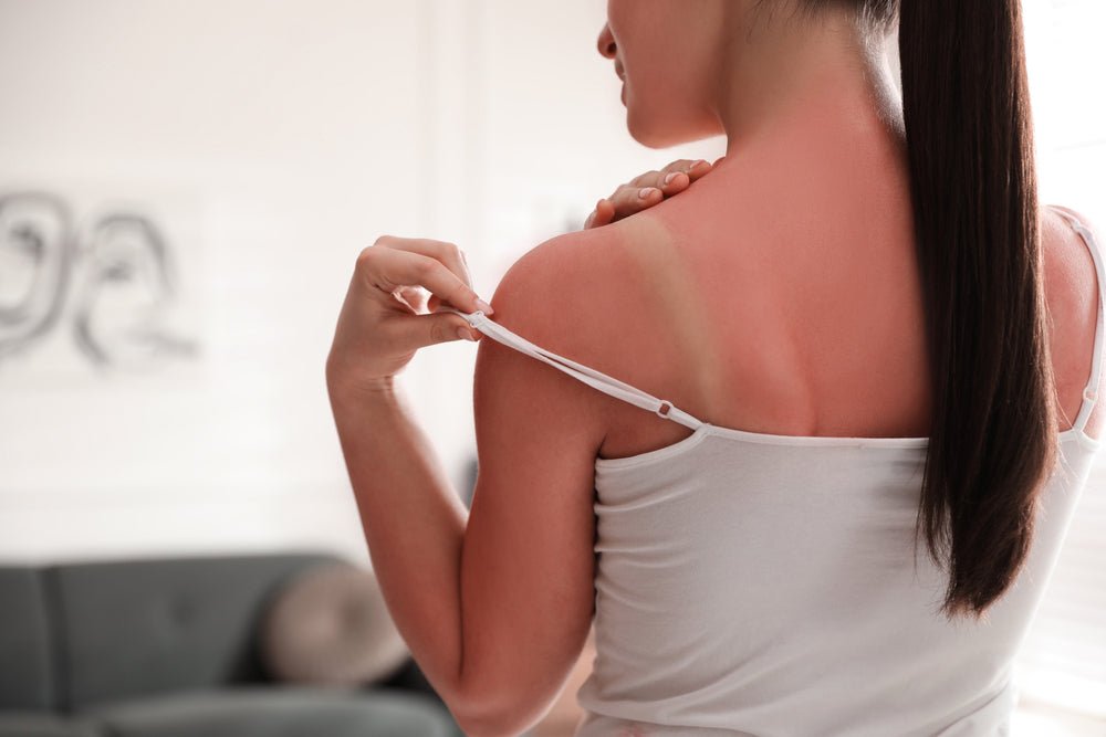 Why You Gotta Shield Yourself from the Sun - LivBalance
